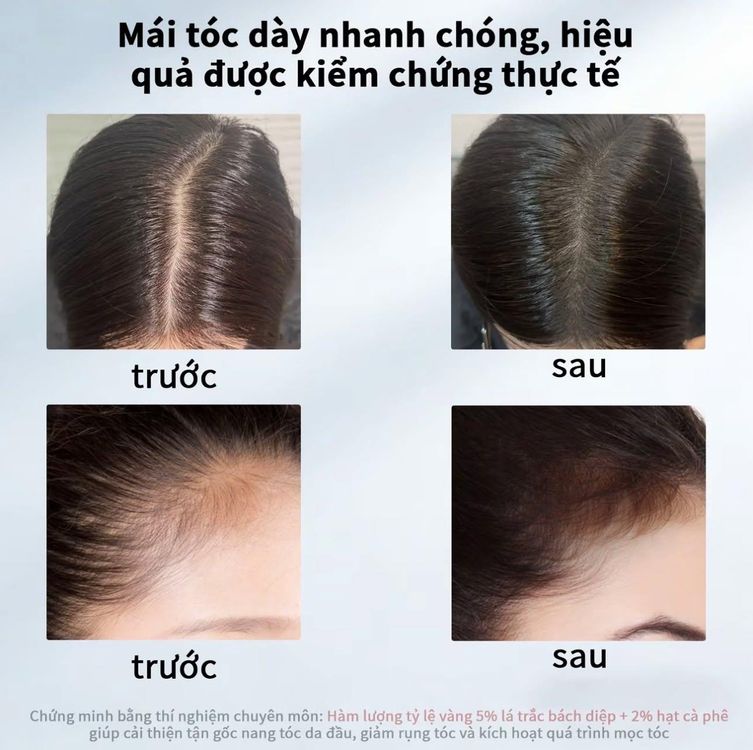 Kết quả chăm sóc tóc