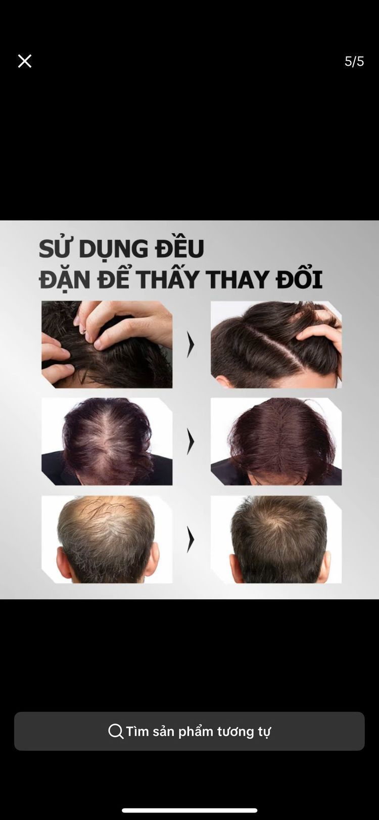 Kết quả trước và sau khi sử dụng